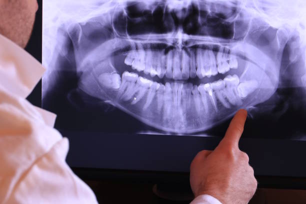 Best Dentist for Severe Toothache  in Corcoran, CA