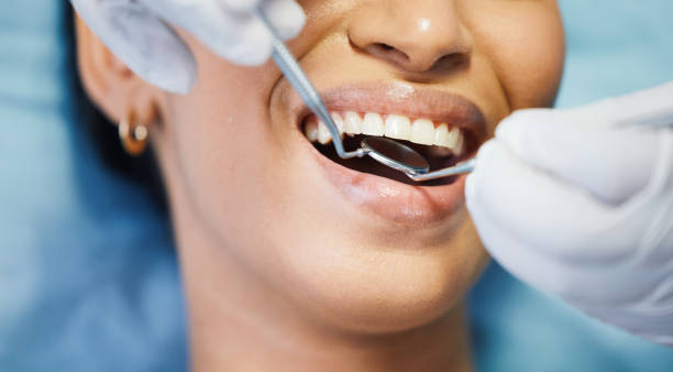 Best Emergency Tooth Extraction  in Corcoran, CA